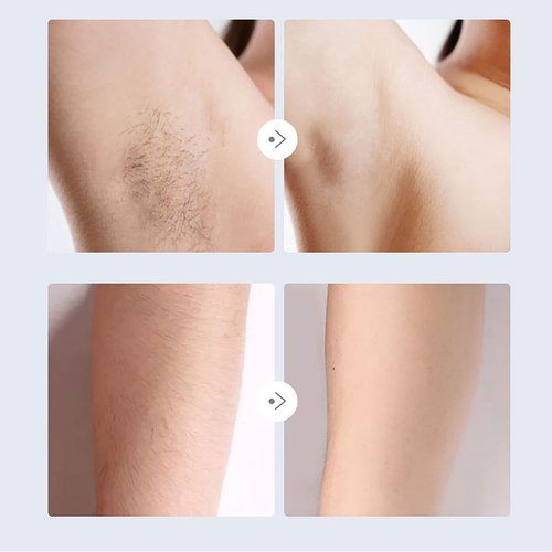 ZJchao Bikini Trimmer and Shaver for Women, 2 in 1 Waterproof Portable Safe Epilator Hair Removal Trimmer for Women Pubic Hair Face Leg Eyebrow Nose Lip Body, Purple