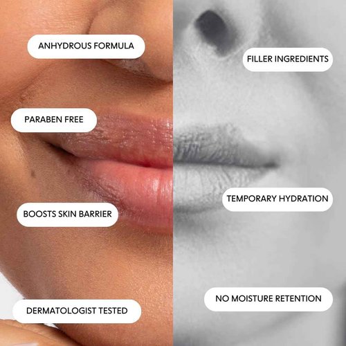LOOPS Dew Cloud Ultra Hydrating Lip Mask - Nourish, Restore, and Replenish Hydration Beyond the Surface - Lip Balm - Gifts for Women, Stocking Stuffer