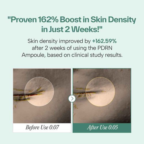 Maybena PDRN 73 Serum 730000ppm Plant-Based Kbeauty with Bakuchiol and Fast Absorption | Korean Facial Serum for Women, Personal Care, Niacinamide, Hyaluronic Acid, Glutathione (1.01 fl.oz）