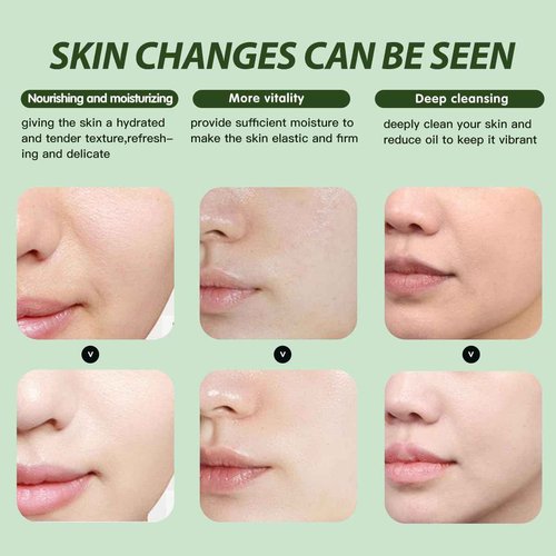 Mnhybteam Jelly Masks For Facials Professional, hydrojelly Mask SkinCare Spa Face Mask Gel Powder Hydrating & Deeply Purifying hydrojelly Mask Spa Set, (Tea Tree Pack of 1), 23 Fl Oz