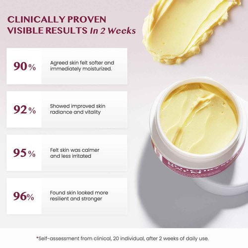 Vigority Helichrysum Balm Soothes & Repairs: Restorative Cream with Arnica & Calendula for Thin, Fragile, Bruised & Aging Skin – Moisturizes & Revitalizes Face & Body – Whipped Texture – 3.4 oz