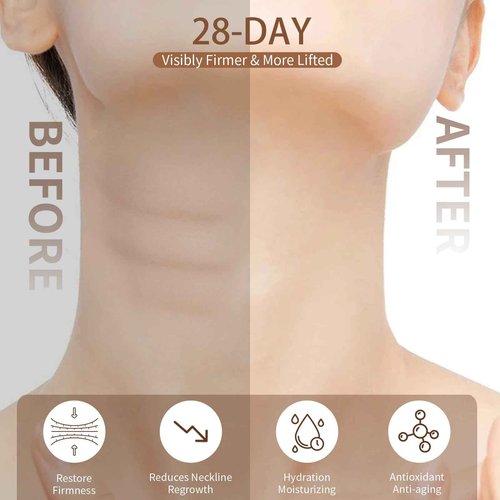 Sheework Neck Firming Cream,Tighten and Lift Neck Cream,Neck Tightening Cream Improves Sagging,Skin Tightening and Smooth of Fine Lines