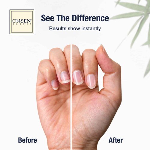 Onsen Secret Cuticle Conditioner Cream 15ml, 3 Way Japanese Nail Buffer Block, 6pcs Nail File Dual Grit. Cuticle Oil Nail Care Serum Sooth, Repair & Strengthen Cuticles & Nails + Shape & Shine Kit