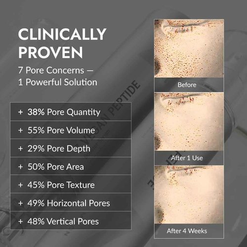 MIZON 7 Vegan Peptide Booster Serum Korean Anti-Aging Face Serum with Niacinamide & Hyaluronic Acid Hydrating Firming & Smoothing Skincare for Fine Lines & Skin Repair – 5.07 fl oz