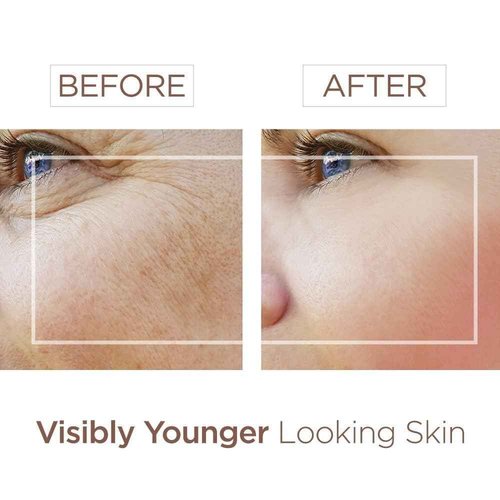 BEE and YOU Anti Aging, Anti Wrinkle Face Cream Serum, Dark Spot Remover, Moisturizer, Pore Minimizer Skin Care, Bee Propolis Extract, Raw Honey, Bee Venom and Hyaluronic Acid, 1.0 fl. Oz
