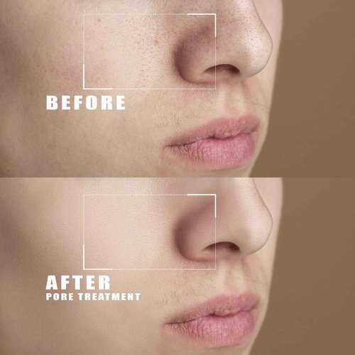 Body and Face Peeling Cream 200ml – Facial Peeling Cream for Deep Cleansing, Exfoliation and Skin Moisturization – for Face Dead Skin Removing, Pore-Unclogging & Skin-Smoothing