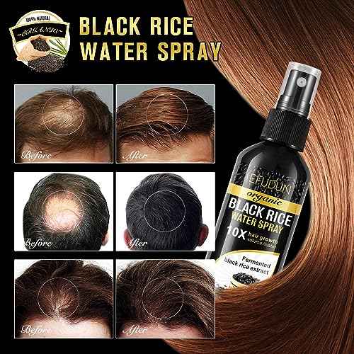 (3Pc) Organic Black Rice Water Spray for Hair Growth, A Solution with Castor Oil & Ginger Root Extract for Thicker, Fuller Hair, Targets Hair Loss and Repairs Damage 300ml/9.6 fl.oz