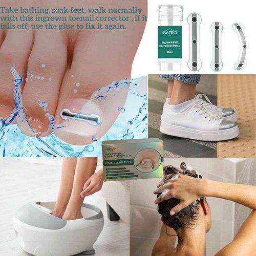 Ingrown Toenail Corrector & Removal Kit - at Home Treatment for Ingrown Toenails, Titanium Alloy Ingrown Toenail Treatment Tools, Nail Tools Designed for Curved Nail Repair Suitable for Men Woman