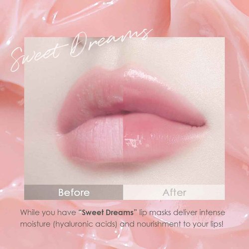 glowiest Sweet Dreams Overnight Lip Mask- Nourishing, Plumping and Hydrating Lip Balm | glowiest Sweet Dreams Lip Sleeping Mask | Hyaluronic Acids+Vitamin C+Shea Butter+Antioxidants l Peach
