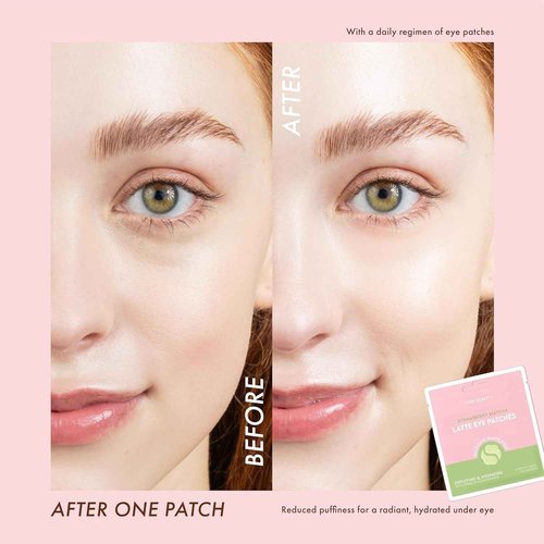ESW Beauty Under Eye Patches Variety Set (10-Pack) – Soothing & Nourishing – Includes Strawberry Matcha & Iced Chai Latte – For Hydrating Dark Circles Under Eyes