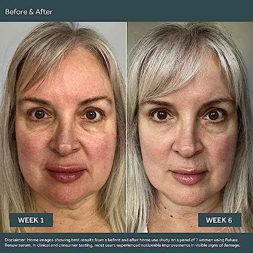 No7 Future Renew Damage Reversal Face Serum - Anti-Aging Serum for Glowing Skin - Hyaluronic Acid + Niacinamide for Sun Damage Reversal - Dermatologist-Approved, Sensitive Skin Suitable (0.33 Fl Oz)