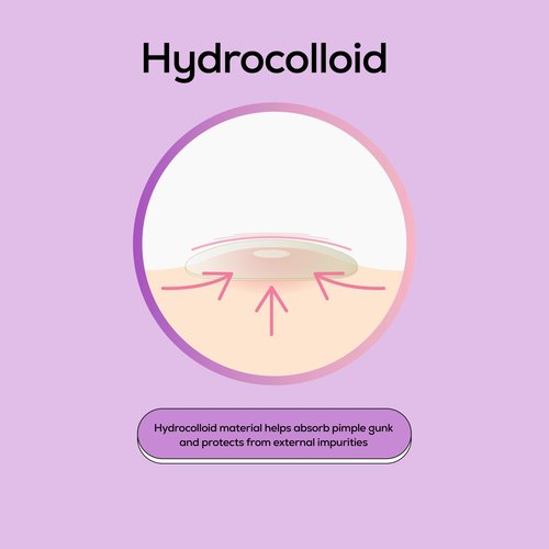 Hanhoo Face & Body Blemish Patch, 6 Patch Sheets, Customizable XL Pimple Patch, Covers Clustered Pimples, For Face and Body Acne, Large Hydrocolloid Patches, Gentle Blemish Care, Korean Skincare