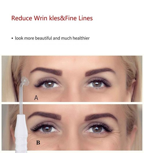 High Frequency Facial Wand/Machine with 5 Argon Parts Skin Care Tool for Wrinkles Reducing Face Skin Tightening.