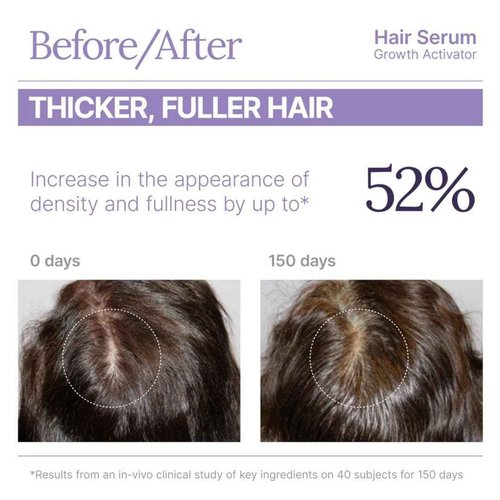 Keranique Hair Growth Activator Serum for Women - Multi-Peptide Scalp Revitalizer for Thinning Hair, Density & Loss Care, Energizing Organic Treatment with Keratin Amino Complex, Peptides & Biotin