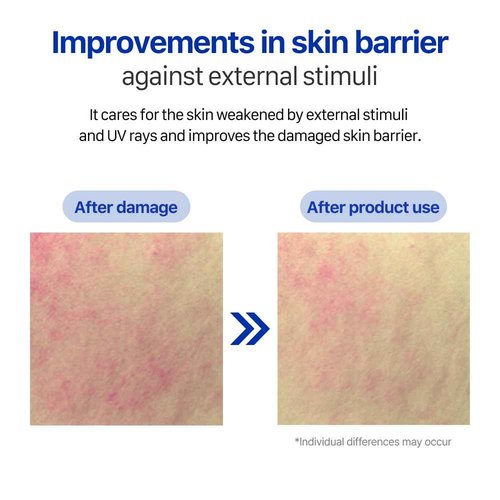 Real Barrier | Extreme Cream Face Sheet Mask | Skin Barrier Repair | Face Masks Skincare | Moisturizing & Hydrating for Dry and Sensitive Facial Types | Facial Moisturizer | Korean Mask | 10 Sheets