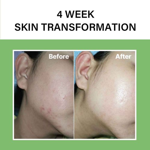 celimax Ji.Woo.Gae Heartleaf BHA Peeling Pad(60 pads) + Noni Energy Ampoule 30ml Bundle
