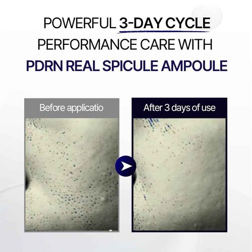 Ultimate Rejuvenation Spicule Serum – Korean Skincare PDRN Serum for Anti-Wrinkle, Pore Care & Skin Renewal – Dermatologist-Tested, Brightening Ampoule for Radiant, Smooth Skin – 50ml