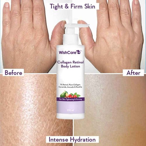 WishCare Collagen 1% Retinol Body Lotion - for Skin Tightening & Firming - with Niacinamide, Ceramide, Rosehip & Avocado - for Men & Women - 200 Ml