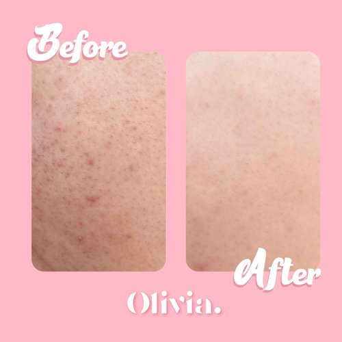 Olivia Beauty Butt Legs and Thigh Nourishing Cream | Razor Bumps & Ingrown Hair Treatment | Cellulite Scrub, Butt Acne Treatment | Fast Absorption, Niacinamide & Tea Tree Oil Formula | 8 Fl Oz