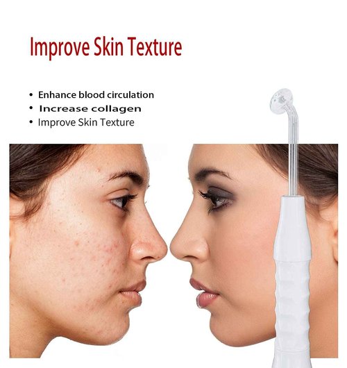 High Frequency Facial Wand/Machine with 5 Argon Parts Skin Care Tool for Wrinkles Reducing Face Skin Tightening.