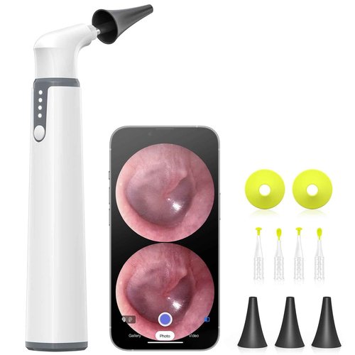 AnyScope Wireless Otoscope with Gyroscope, Ear Camera with Dual View, 3.9 mm Otoscope with Light, Ear Scope with Ear Wax Removal Tool for Kids, Adults, and Pets, Compatible with iPhone and Android
