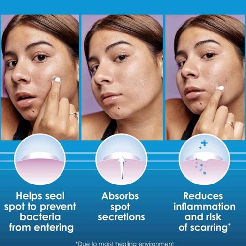 Clearasil Stubborn Acne Control 5in1 Pimple Patch, 18 Count (Pack of 3)