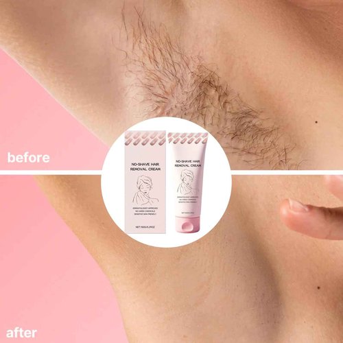 Bare Basic Hair Removal Cream,No Shave Hair Remover for Women, Suitable for Sensitive Skin, Fast and Gentle, Moisturizes and Nurtures Skin, Leaving it Soft and Protected after Hair Removal (1pcs)