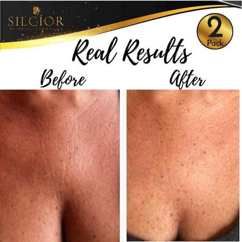 SILCIOR 2 PACK Silicone Chest Wrinkle Pads, Reusable Anti-Wrinkle Decollete Patches, Overnight Chest Smoothing Pads for Fine Lines, Skin-Firming Crepe Pad