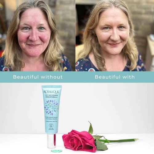 Rosalique 3 in 1 Anti-Redness Miracle Formula SPF50 1 x 30 ml