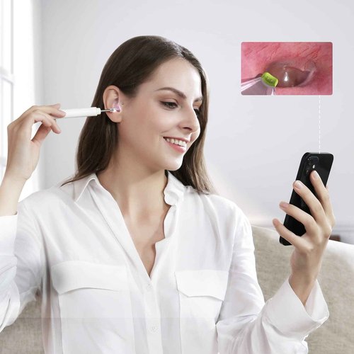 ScopeAround Ear Spoon with Ear Camera Otoscope Accessories, Compatible with Digital Otoscope, Includes 9 Speculums, 4 Ear Picks, and 1 Pack of Q-Tips, Lens Diameter: 3.9mm