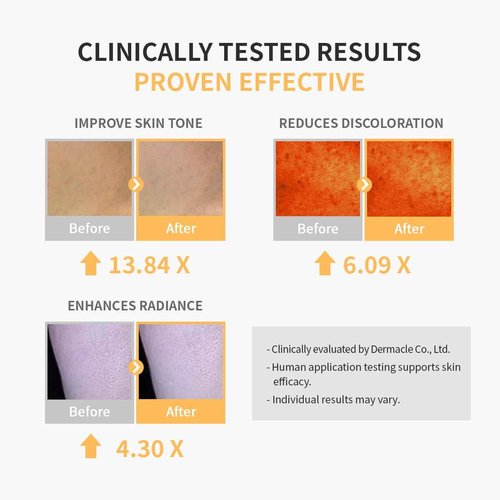 glowiest Dream Glow Vitamin C Serum | Even Skin Tone Serum l Glowing Skin - Niacinamide (20,000 ppm), Hyaluronic Acid, Camellia Flower Extract, Centella Extract | Korean Skin Care - 1.01 fl.oz (30 ml)