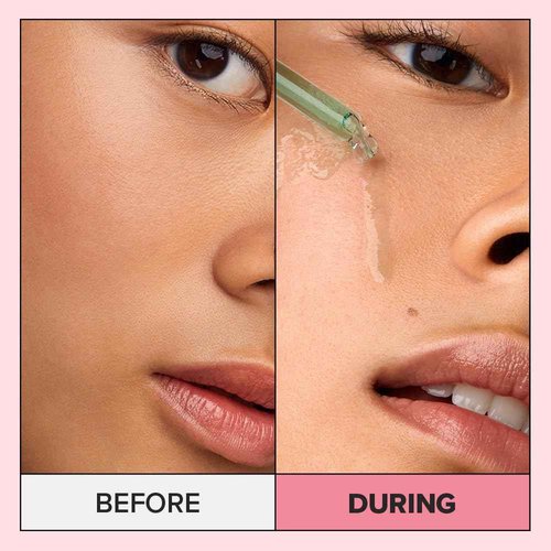 I DEW CARE Juicy Kitten | Purifying Power-Green Face Serum with Niacinamide | Korean Skin Care, Vegan, Cruelty-free, Paraben-free | Gifts For Mom and Women