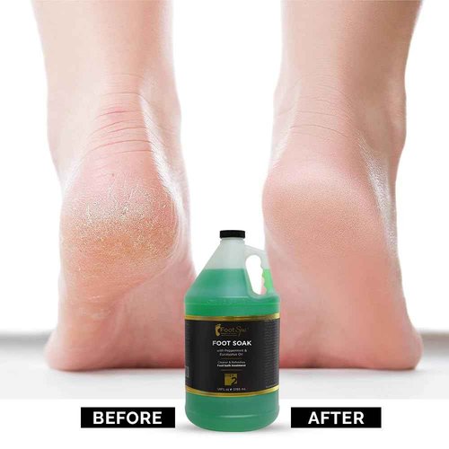 FOOT SPA - Foot Soak - Cleanses, Softens, and Refreshes - Made With Eucalyptus & Peppermint Oil - 128 Oz Gallon - Bulk, Refill Gallon