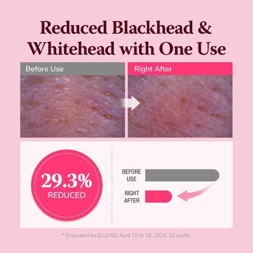 HIMALAYA PINKSALT Pore & Blackhead Deep Cleansing Oil BHA, 6.7 fl oz 2 Pack - Pore Purifying Oil Cleanser with BHA for Blackhead Removal, Makeup Remover with Refreshing Low Alkaline Formula