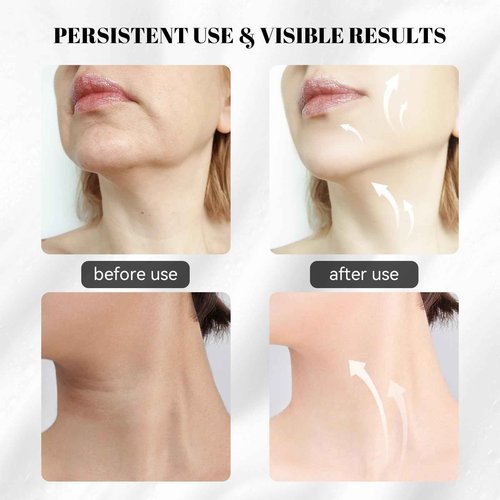 Sveekery 3-in-1 Facial Sculptor with Red Light Therapy, Microcurrent & Vibration Massager, Portable Anti-Aging Device for Face and Neck Care, Wrinkle Reducer Face Lift Tool (White)