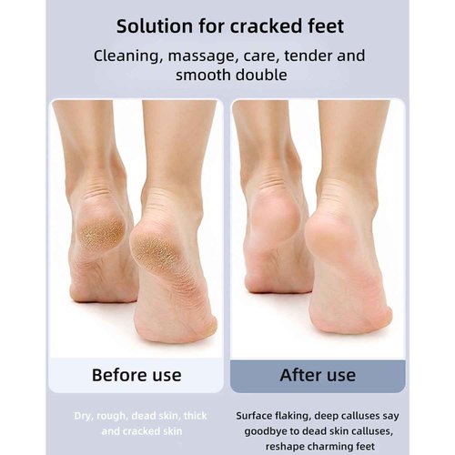 Foldable Foot Callus Remover Tool Electric-Professional Aluminum Callus Remover for Feet-Stepless Speed Control Pedicure Tools for Dead Skin with 20pcs Sandpaper Discs
