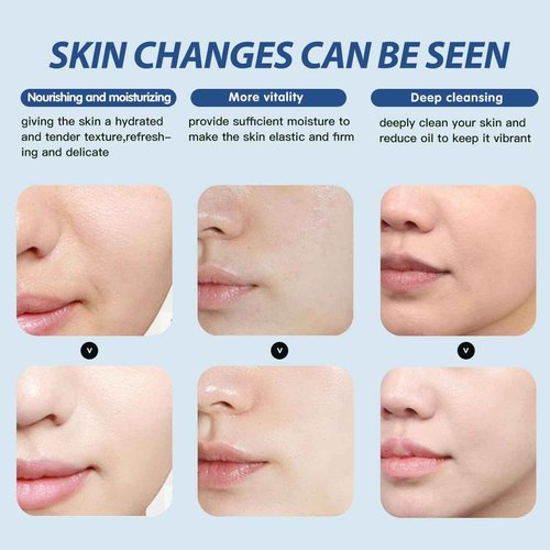 Mnhybteam Jelly Mask For Facials Professional, Facials Masks Professional Spa For All Skin Types, Hydrating & Moisturizing Rubber Peel-Off Gel Face Mask SkinCare, 23 Fl Oz (Hyaluronic Acid Pack of 1)