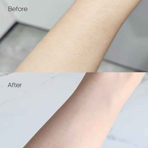 PELCAS Bikini Trimmer for Women Kit 6 in 1 Electric Shaver, Cordless Razors, Nose Hair Trimmer, Shaver for Women & Men Pubic Hair, Private Area, Legs, Face, Nose, Eyebrow, Body Hair Removal