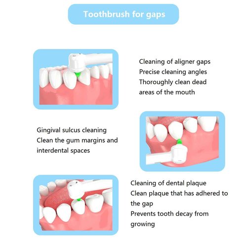 Sonic Fusion Teeth Cleaning kit with 3 Modes Electric flossing Water flosser and Toothbrush and with Portable Water flosser Combo for Travel and Home (White)