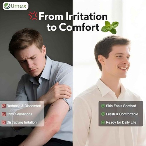 Umex Intensive Itch Relief Cream - Daily Moisturizing Lotion for Sensitive Skin, Soothes Dry & Flaky Skin, Non-Greasy & Fragrance-Free 2PCS(60g/2.12oz)