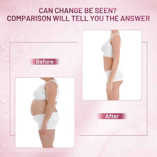 ZZILME B TIGHT Cellulite Cream – Butt Firming Cream for Smoothing, Tightening & Lifting Booty & Arms, Reduces Cellulite Appearance Korean Skincare 4.23 Fl Oz
