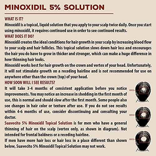 Suavecito Hair Loss Treatment Kit For Hair Regrowth - Minoxidil 5%, Hair Thickening Shampoo & Conditioner With Niacinamide & Biotin, Matte Hair Cream With DHT Blocker For Styling Thinning Hair To Look Thick & Full With Volume