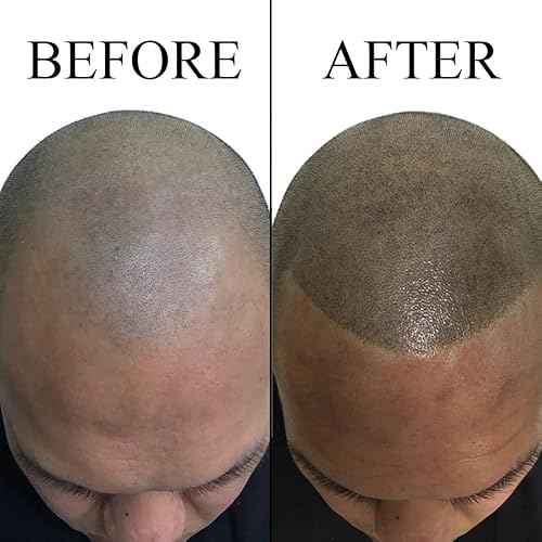 Nuva Scalp Micro-Pigmentation Ink - Customizable, Neutral Undertone for SMP Procedures, Vegan, Made in USA (SMP (8-Pack))