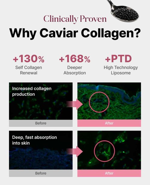 Delere Caviar Glow Smoothing Serum | Caviar Collagen with Niacinamide and Retinol for Face | Korean Serum for Glowing Skin and Radiant Glass Skin, 1.7oz