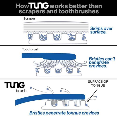 Tung Tongue Gel, Natural Mint Blast Tongue Cleaner Paste, Bad Breath Odor Eliminator, Halitosis Defense, BPA Free, USA Made (4-Pack)