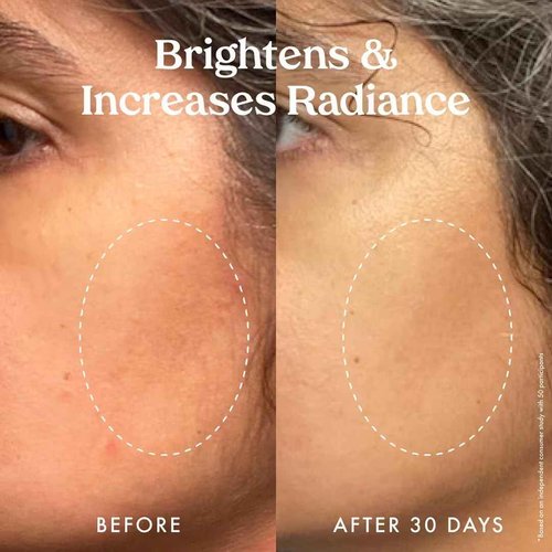 Kopari Star Bright Vitamin C Discoloration Correcting Serum with Kakadu Plum & Niacinamide, Brighter Complexion, Soothe & Diminish Dull Skin, 1.7oz