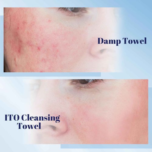 ITO Disposable Face Towel, Ultra-Soft 1-Second Quick-Dry Face Towels, Gentle for Sensitive Dry Oily Skin, Facial Towels for Daily Cleansing Makeup Removal (180 Count (Pack of 3))