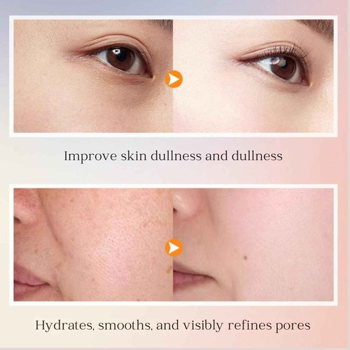 6PCS 5x Vitamin C Skincare Set with Niacinamide – Includes Cleanser, Toner, Serum, Eye Cream, Face Cream & Lotion – Hydrating 5 Heavy Vitamin C Korean Skincare Gift Kit for Women