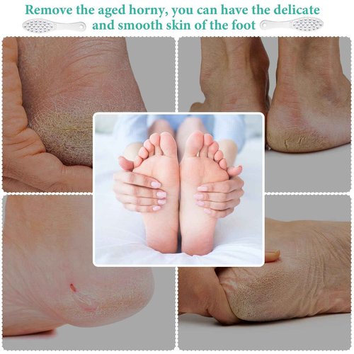 4 Pcs Stainless Steel Foot Scraper Metal Foot File Double Sided File Callus Remover Professional Feet Rasp Scrubber for Wet or Dry Skin Easy to Clean Pedicure Tool Heel