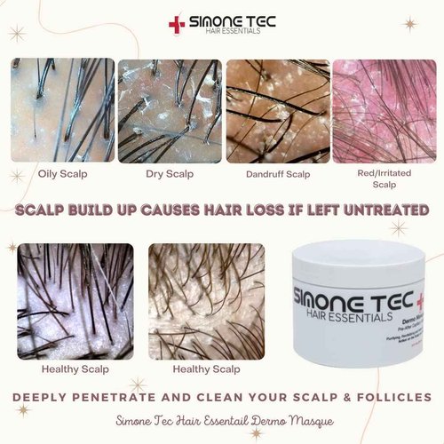 Simone Tec Hair Essentials Dermo Pre-After Capillary Mask 236ML Purifying, Revitalizing and Balancing Action on the Scalp and Hair